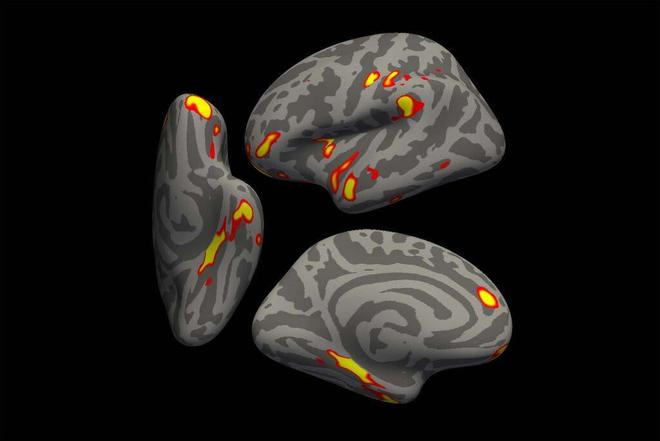 12fbe19c53324fd59a630b275f084b8c.png